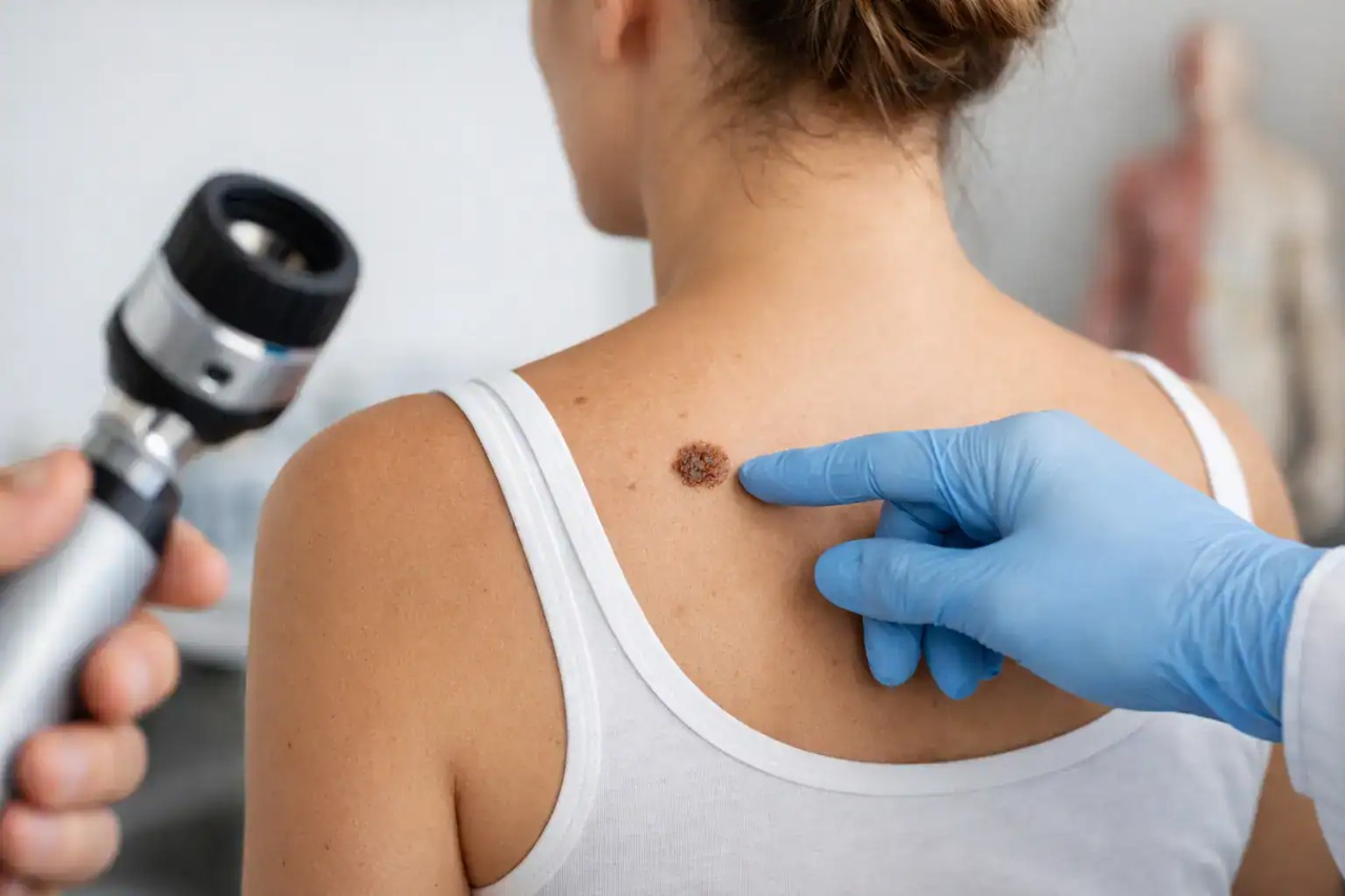 How Moles Form and When They Start to Matter