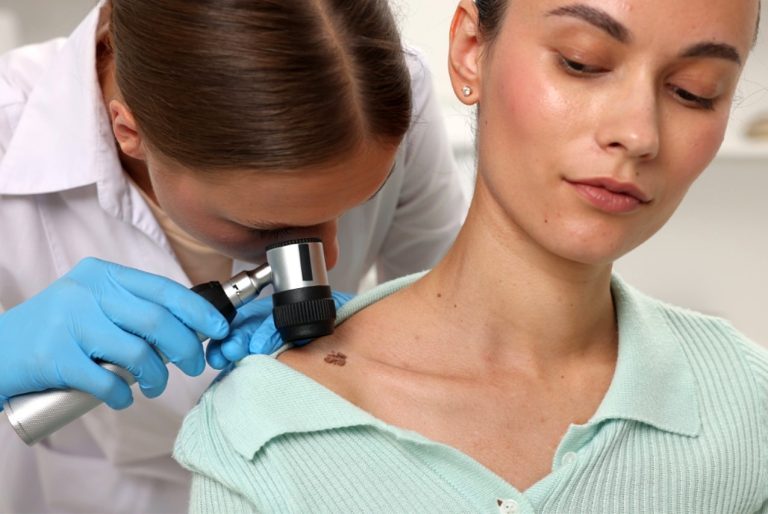 Skin Health on the Road: What a Suspicious Mole Is Telling You